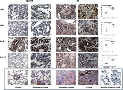 Casein Kinase 1δ/ε Inhibitor, PF670462 Attenuates the Fibrogenic Effects of Transforming Growth Factor-β in Pulmonary Fibrosis